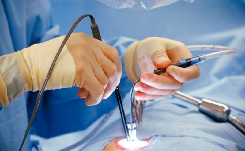 Cắt trĩ uy tín, không đau, nhanh chóng hồi phục