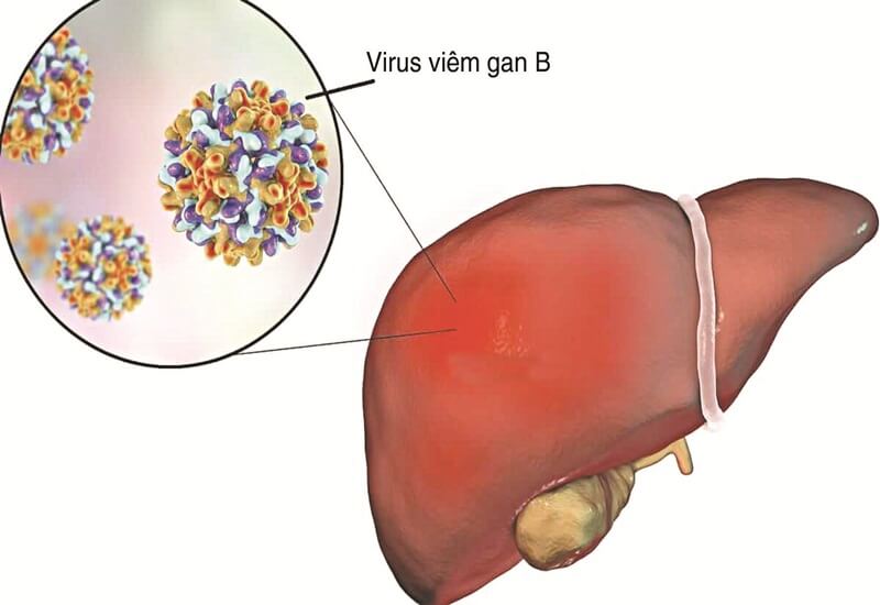 Nguyên nhân và con đường lây nhiễm viêm gan B