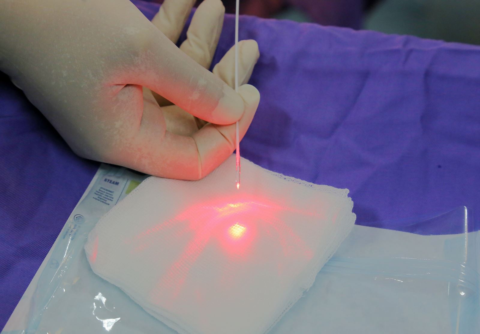 Điều trị trĩ ở trẻ em bằng laser có an toàn không?